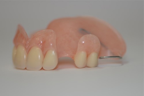 New Dentures What To Expect Brooklyn NY 11238